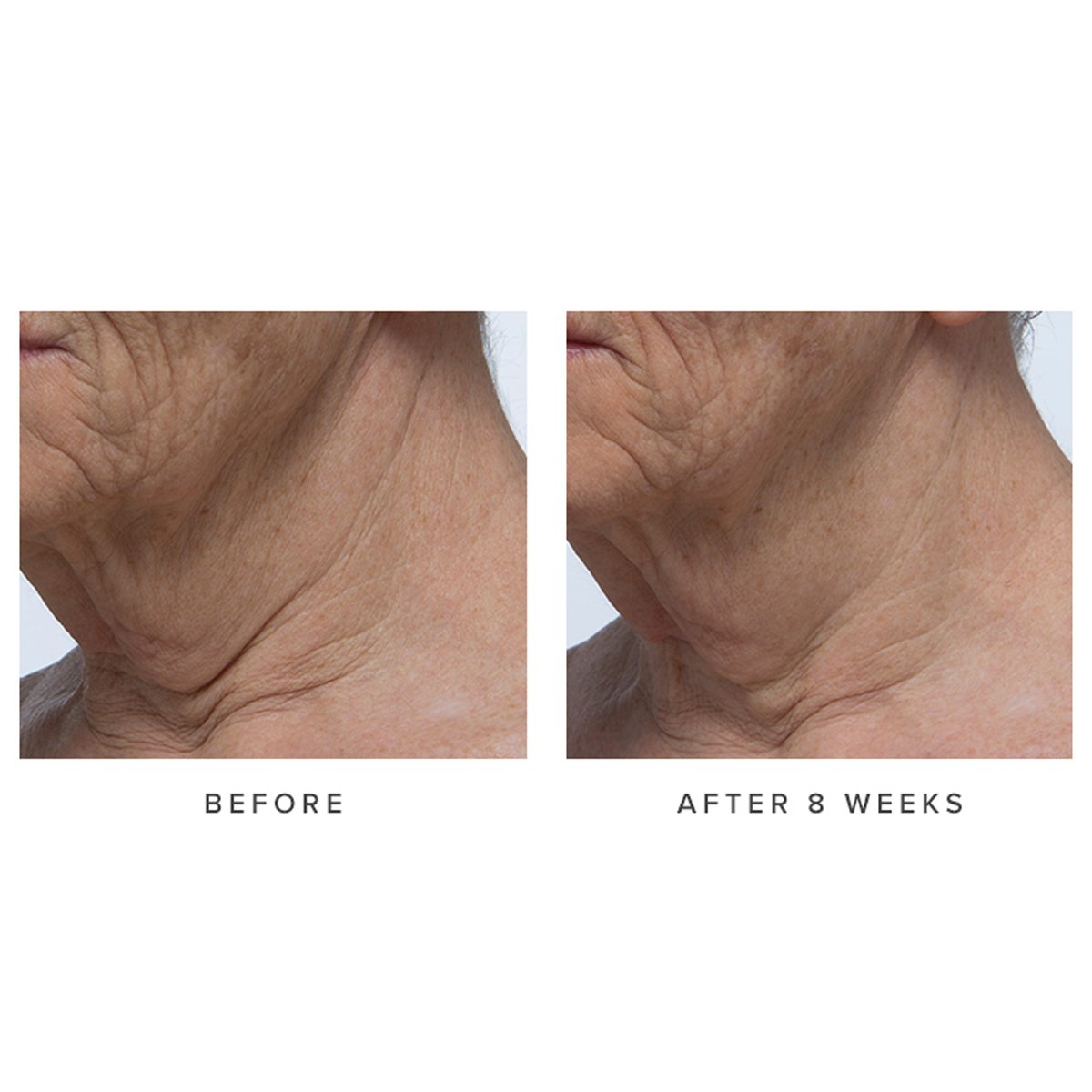 Ageless Revitalizing Neck Cream Gentle Neck Cream for Daily Care
