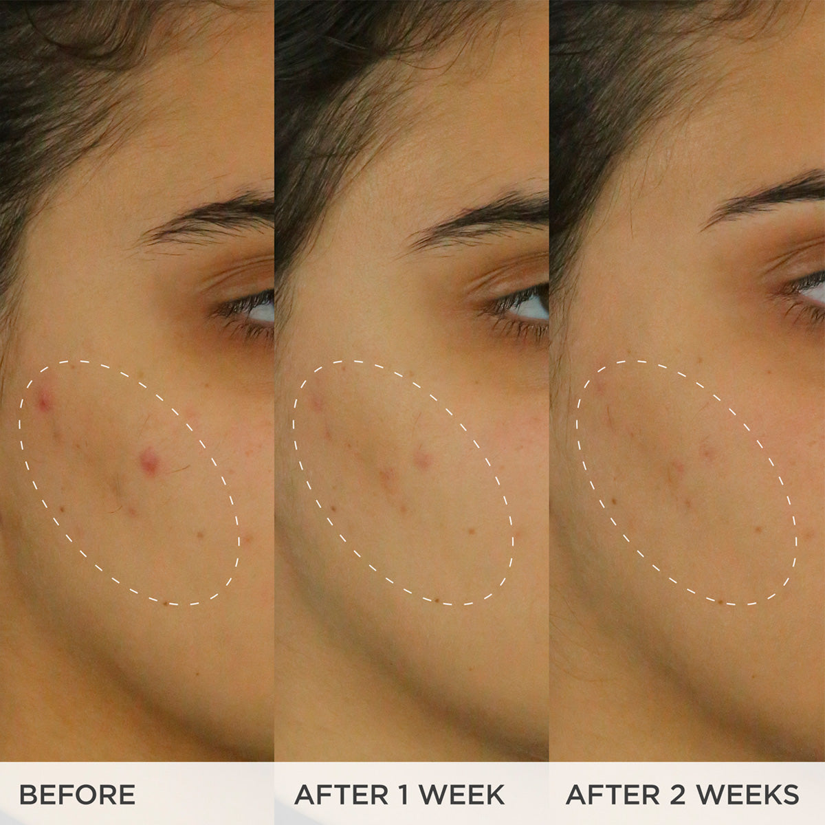 The Brightening Serum Gentle Face Serum for Daily Care