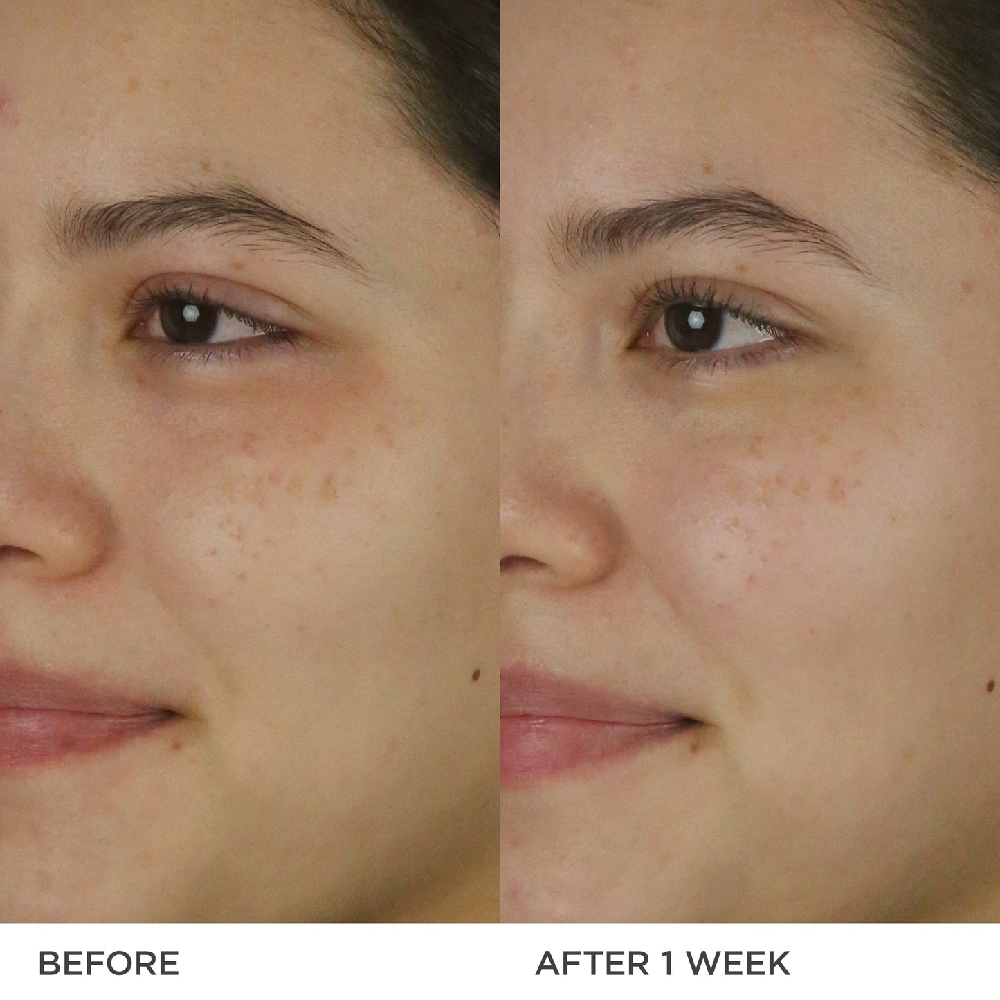 The Dewy Milk Moisturizer Gentle Face Moisturizer for Daily Care