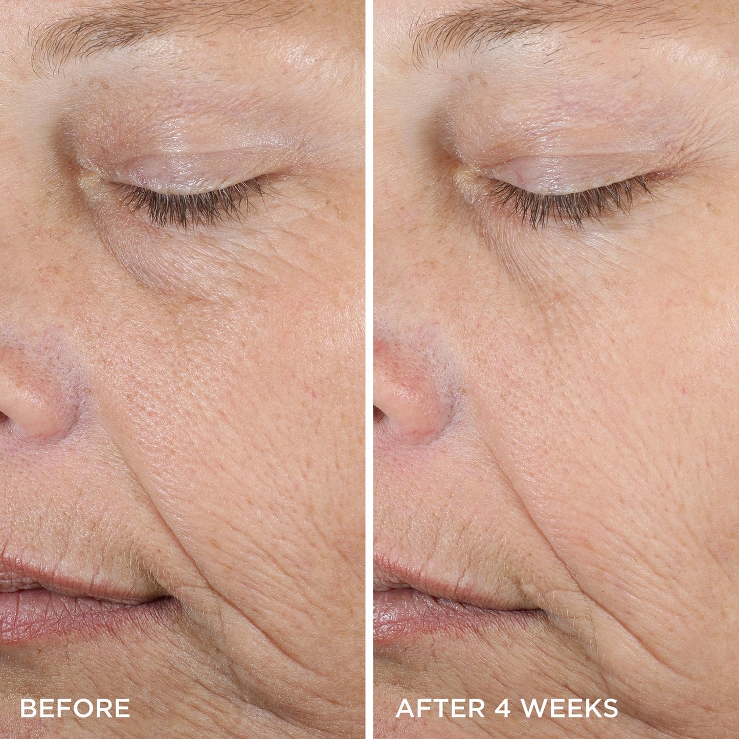 The Dewy Serum Gentle Face Serum for Daily Care