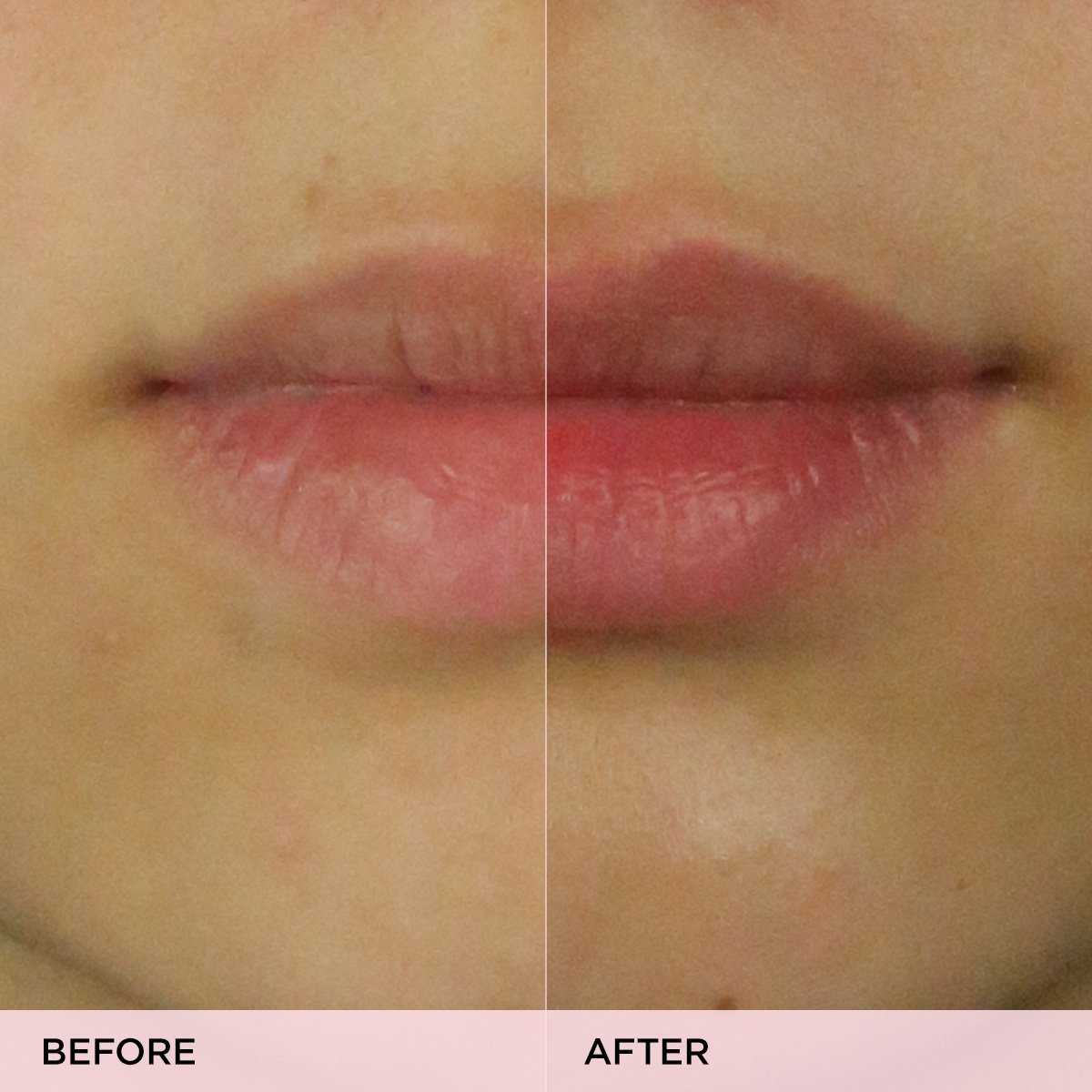 The Kissu Lip Scrub Gentle Lip Scrub for Daily Care