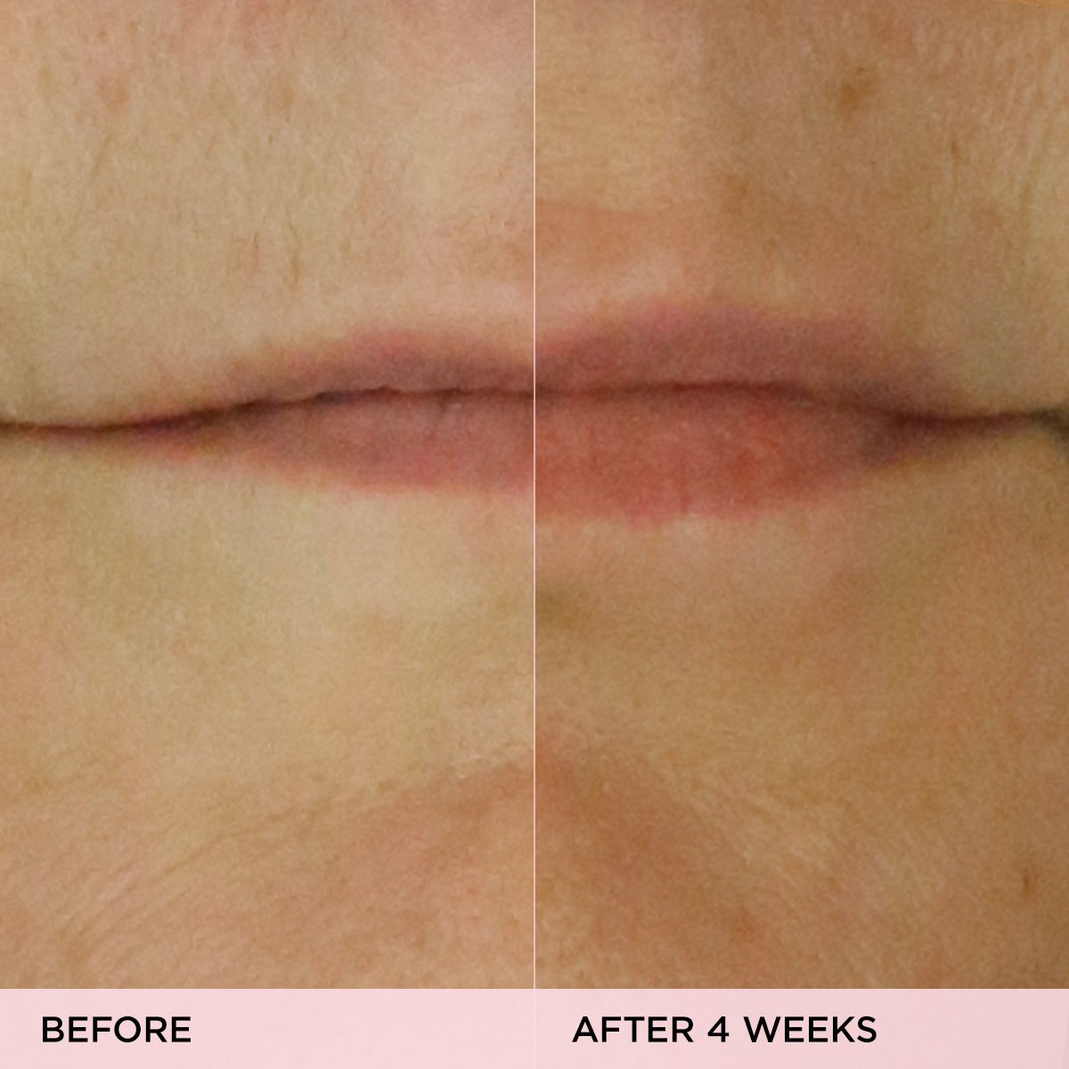 The Kissu Lip Treatment Gentle Lip Care for Daily Care